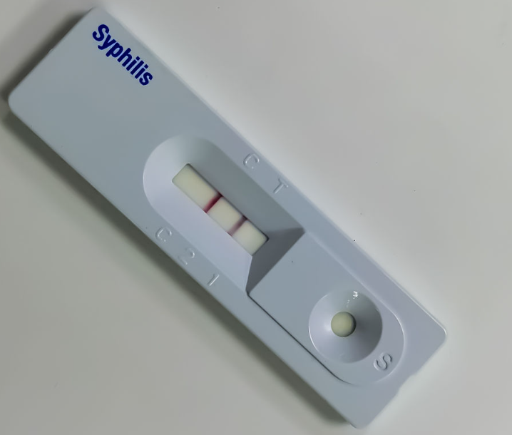 Syphilis Antigen Rapid Test Test Strip